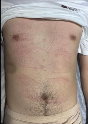 女S板鞋帆布鞋长时间站立踩踏，满身鞋印 ACYC-5054BP